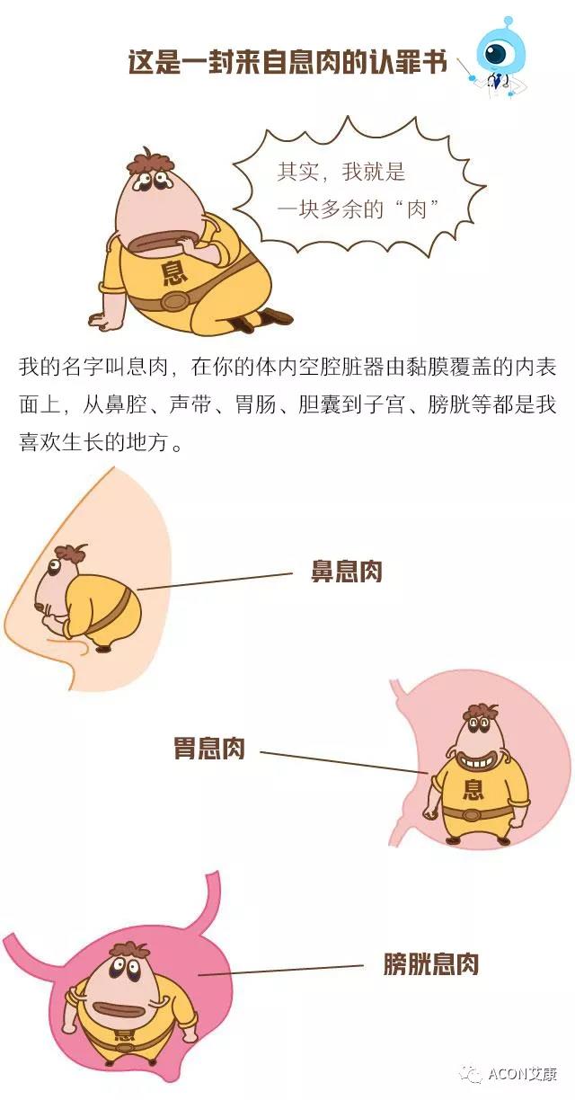 “艾”漫畫 | 這是一封來自息肉的《認罪書》