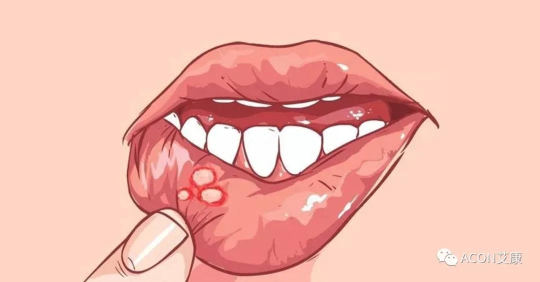 哪些小病容易讓人忽視，最后造成越拖越嚴重呢？