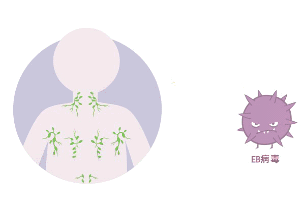 體檢查出“EB病毒”陽性！一定就是鼻咽癌嗎？