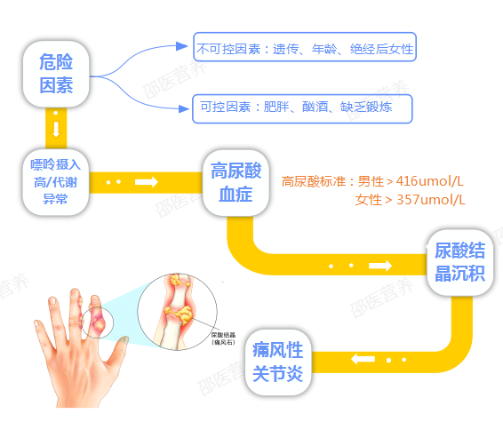 痛風為什么偏愛男性？你最關心的問題都在這里
