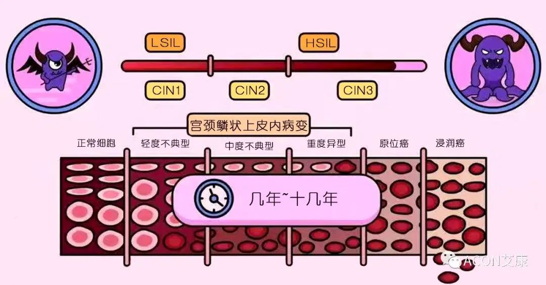 全球首次承諾消除一種癌癥，預計到2050年將挽救500萬人的生命