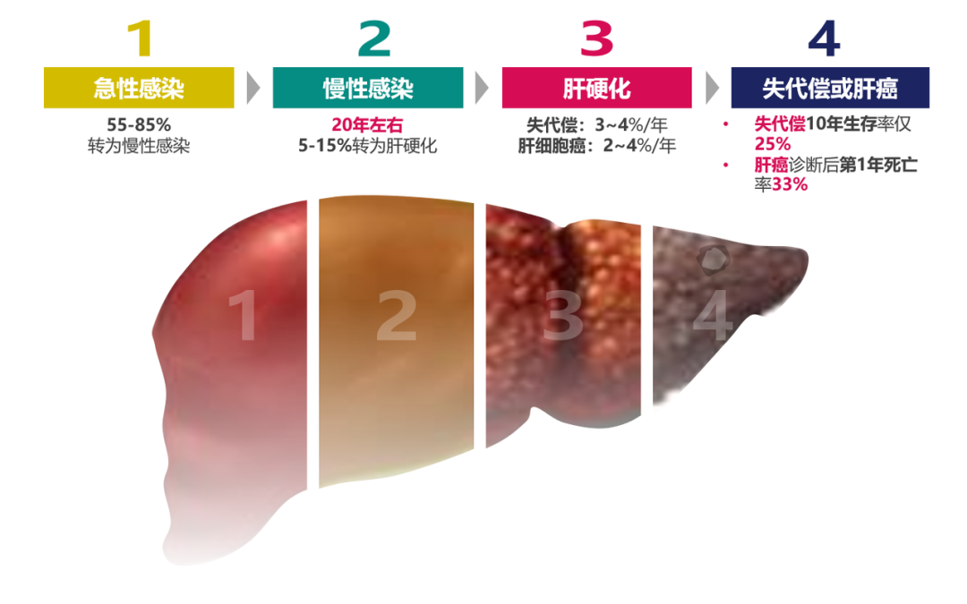 悄悄變成肝硬化、肝癌，很多人感染了卻不知道