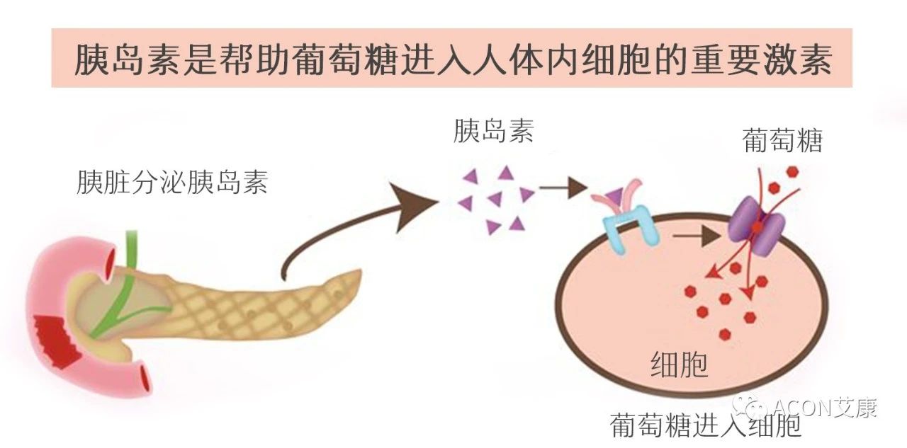 爆上熱搜，因爆發(fā)型糖尿病進(jìn)入ICU，有哪些教訓(xùn)值得我們汲取