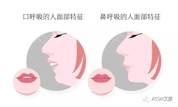 過敏性鼻炎會讓孩子變傻？！家長該如何應(yīng)對
